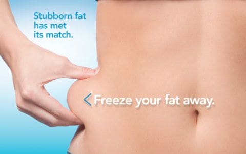 Hips treatment Beaconsfield From Lipo Sculpt