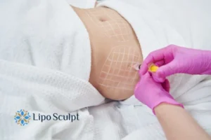 Are The Results From Aqualyx Permanent? 1 Do you want to know how long Aqualyx Beaconsfield results last?