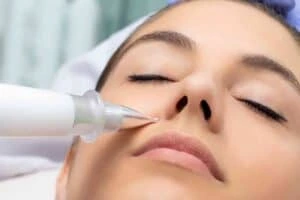 Best Actinic Keratoses Removal 3 Actinic keratoses Beaconsfield solutions - book in today!